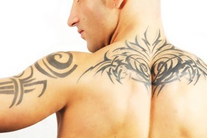 rimozione tatuaggi laser. laser q-switched, Roma Perugia Grosseto